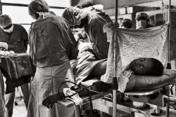 Amputation Amputation