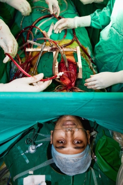 awake heart surgery awake heart surgery