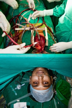 awake heart surgery